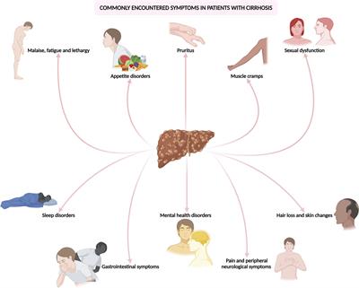 Commonly encountered symptoms and their management in patients with cirrhosis